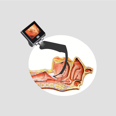 Laryngoscope วิดีโอใบมีดสแตนเลสแบบใช้ซ้ำได้ 5 ใบ