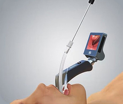 Laryngoscope วิดีโอแบบแข็ง CMOS มุมมองแบบเต็มขนาด 3 นิ้วพร้อมใบมีดแบบใช้ซ้ำได้ 5 ขนาด