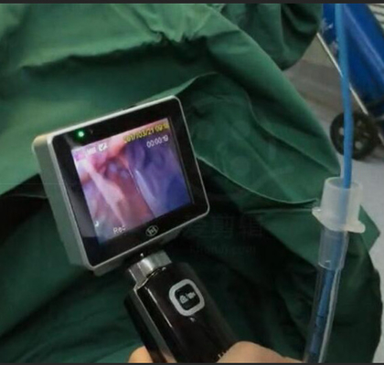 ICU EMS Single Use Intubation Video Laryngoscope พร้อมความละเอียดกล้อง 1280 X 720