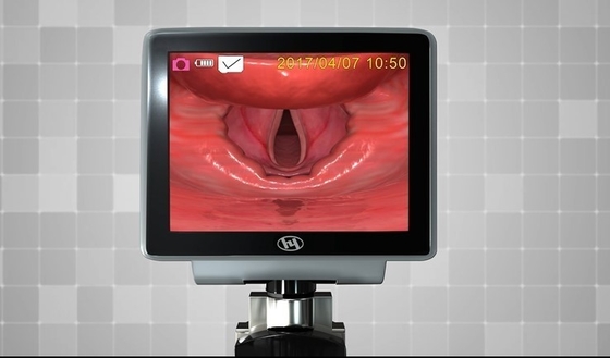 HYHJ 1320 พลาสติกไฟเบอร์ออปติกวิดีโอ Laryngoscope พร้อมใบมีดแบบใช้แล้วทิ้ง