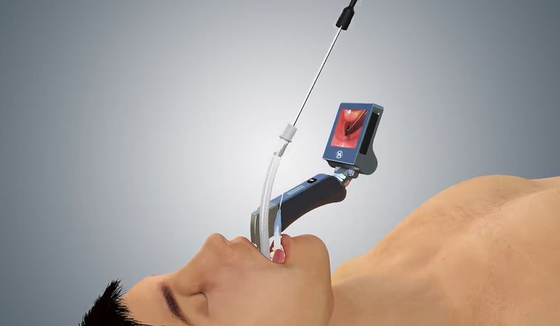 5 Mac Miller Blades Medical Digital Video Laryngoscope พร้อมด้ามจับตามหลักสรีรศาสตร์