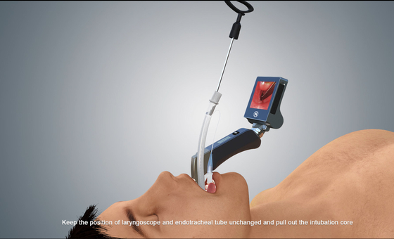 กล้องส่องทางไกลวิดีโอ USB แบบพกพา HD ผู้ใหญ่สำหรับเด็ก Haiye Medical