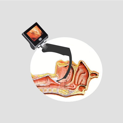 กล้องวิดีโอ Laryngoscope แบบใช้มือถือ CMOS Intubation พร้อมการแสดงภาพ Glottis Hyperangulated 70 องศา