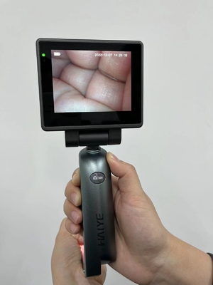 จอแสดงผล HD 3.0 นิ้ววิดีโอทางการแพทย์ Laryngoscope - Intubation Video Laryngoscope