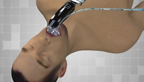 หน้าจอ 3.0 นิ้วโรงพยาบาล Ent อิเล็กทรอนิกส์ Endoscope Optical Laryngoscope เอาต์พุต USB