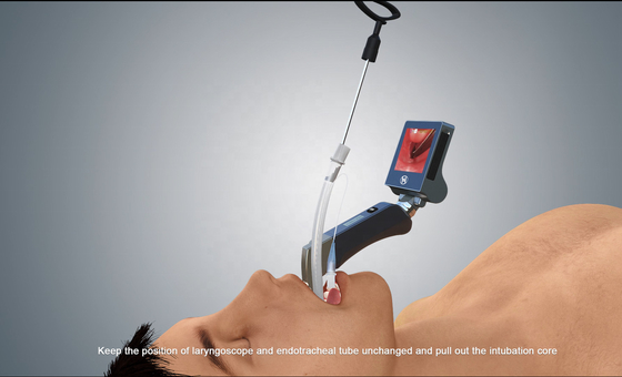 ใบมีดแบบใช้ซ้ำได้ Fiber Optic Mcgrath Video Laryngoscope ISO13485