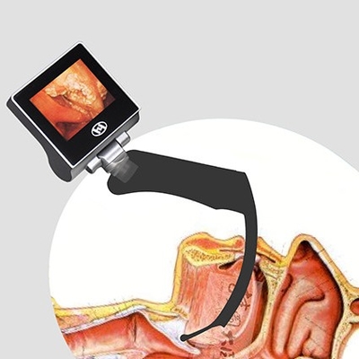 360 องศา LCD นำกลับมาใช้ใหม่ Anesthesia Video Laryngoscope 2 ล้านพิกเซล