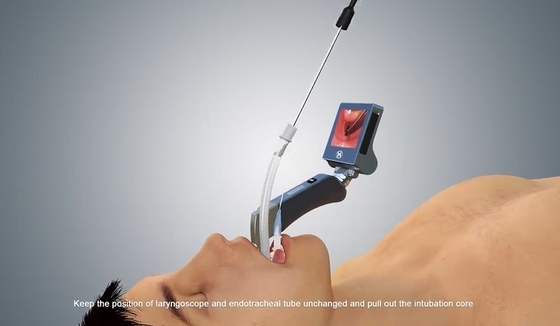 HYHJ-KC วัสดุโลหะเกรดทางการแพทย์ ระบบกล้องป้องกันฝ้าแบบดิจิตอล Video Laryngoscope