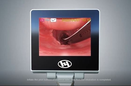 HYHJ-KC วัสดุโลหะเกรดทางการแพทย์ ระบบกล้องป้องกันฝ้าแบบดิจิตอล Video Laryngoscope