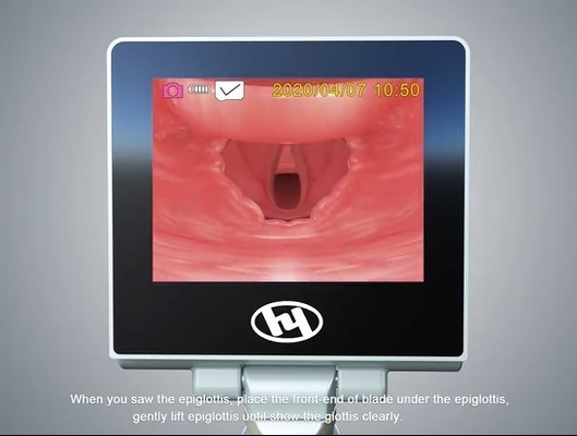 การผ่าตัดแบบพกพา Medical Handheld Reusable ภาพวิดีโอยืดหยุ่น Laryngoscope พร้อมใบมีดสแตนเลสแบบใช้ซ้ำได้